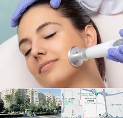 پلاسما جت در آپادانا