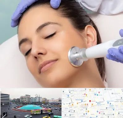 پلاسما جت در میدان انقلاب