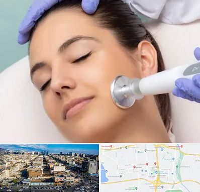 پلاسما جت در شهرک راه آهن