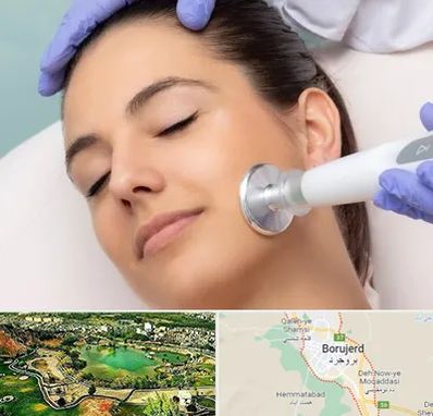 پلاسما جت در بروجرد