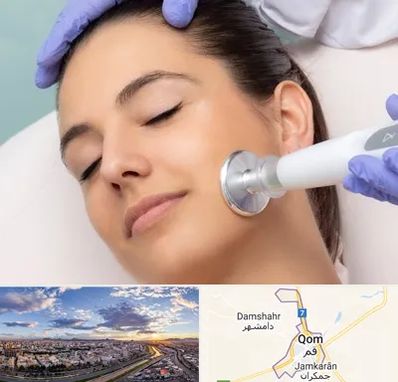 پلاسما جت در قم