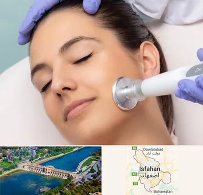 پلاسما جت در اصفهان