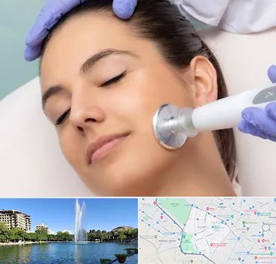 پلاسما جت در کوهسنگی مشهد