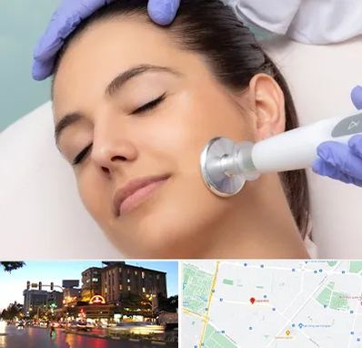 پلاسما جت در بلوار سجاد مشهد