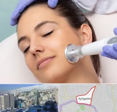 پلاسما جت در محمودیه
