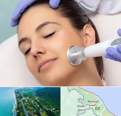 پلاسما جت در رامسر