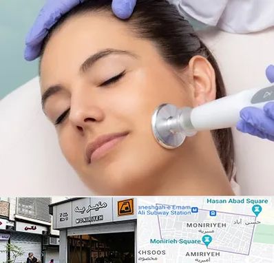 پلاسما جت در منیریه