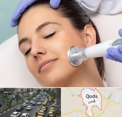 پلاسما جت در شهر قدس