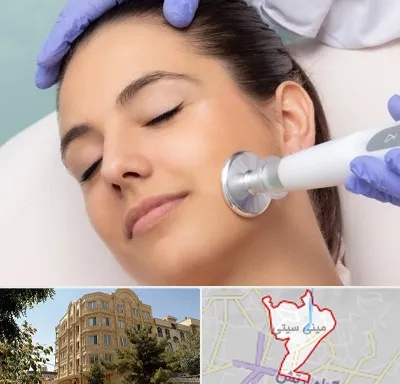 پلاسما جت در مینی سیتی