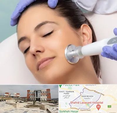 پلاسما جت در حکیمیه