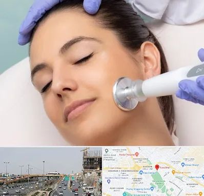 پلاسما جت در بلوار توس مشهد