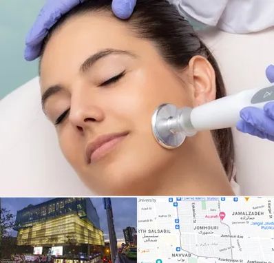 پلاسما جت در جمهوری