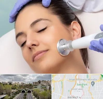 پلاسما جت در یوسف آباد