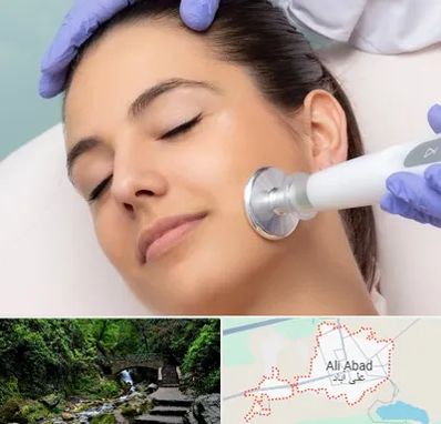 پلاسما جت در علی‌ آباد کتول