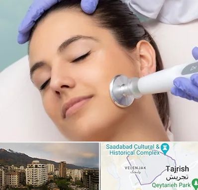 پلاسما جت در زعفرانیه