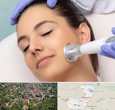 پلاسما جت در دماوند