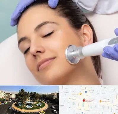 پلاسما جت در هفت حوض