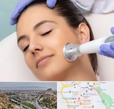 پلاسما جت در معالی آباد شیراز