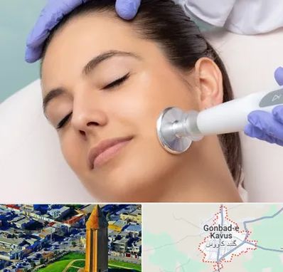 پلاسما جت در گنبد کاووس