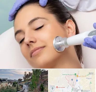 پلاسما جت در باغستان کرج