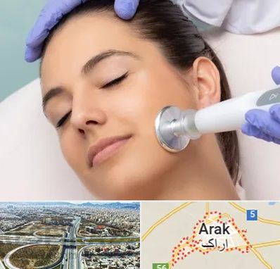 پلاسما جت در اراک