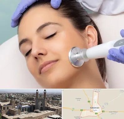 پلاسما جت در سبزوار