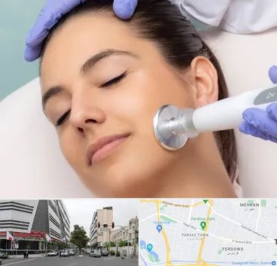 پلاسما جت در بلوار فردوس