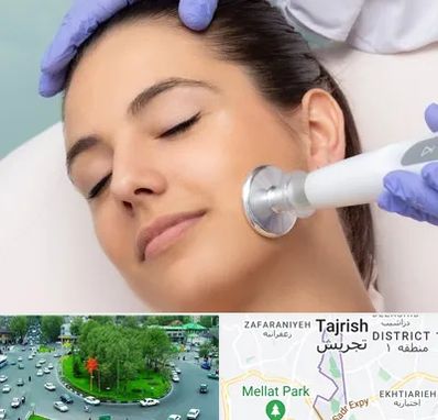 پلاسما جت در تجریش