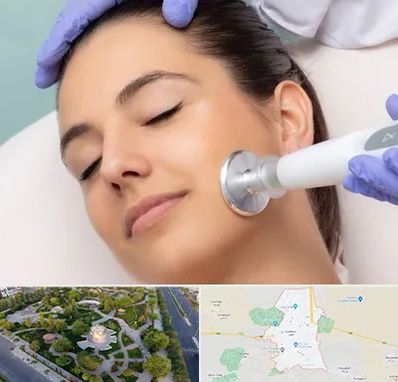 پلاسما جت در کاشمر