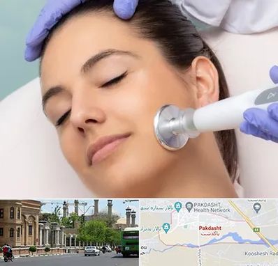 پلاسما جت در پاکدشت