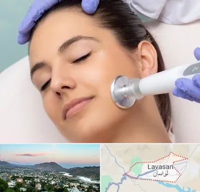 پلاسما جت در لواسان