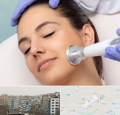 پلاسما جت در محمد شهر کرج