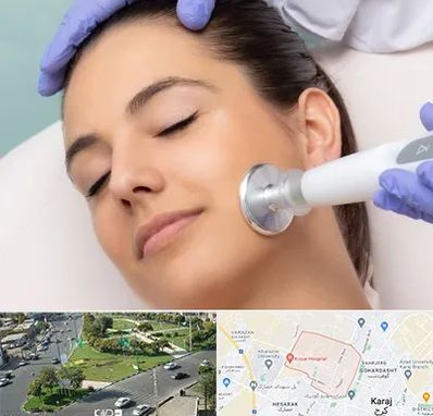 پلاسما جت در شاهین ویلا کرج