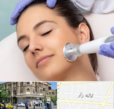 پلاسما جت در لاله زار
