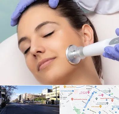 پلاسما جت در خیابان ملاصدرا شیراز