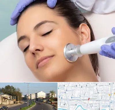 پلاسما جت در ضیابری رشت