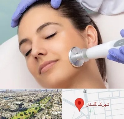 پلاسما جت در شهرک گلستان