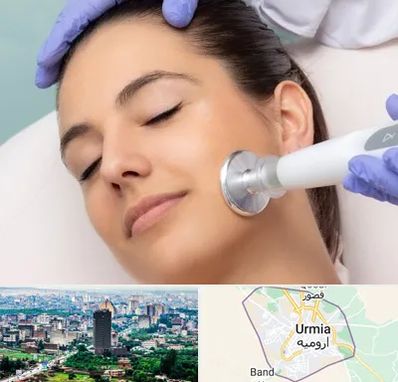 پلاسما جت در ارومیه