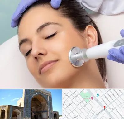 پلاسما جت در مصلی مشهد