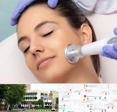 پلاسما جت در طالقانی