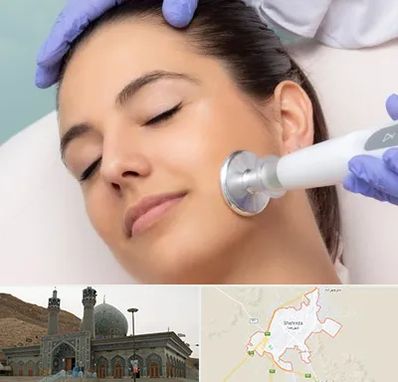 پلاسما جت در شهرضا