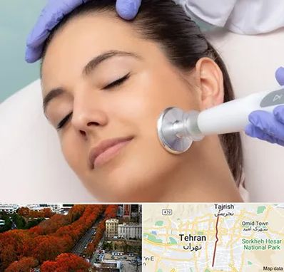 پلاسما جت در ولیعصر