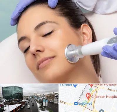 پلاسما جت در اقدسیه