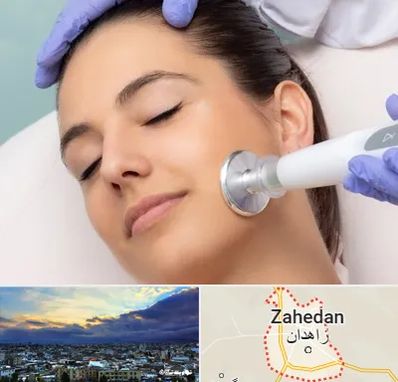 پلاسما جت در زاهدان