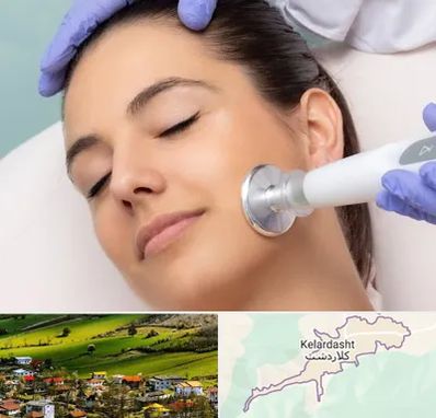 پلاسما جت در کلاردشت