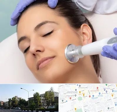 پلاسما جت در میدان کاج