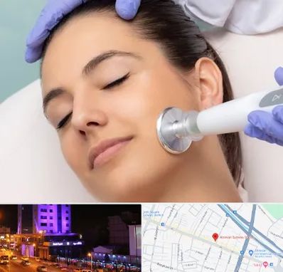 پلاسما جت در آبرسان تبریز