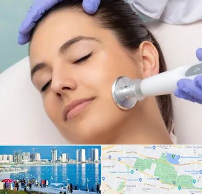 پلاسما جت در چیتگر