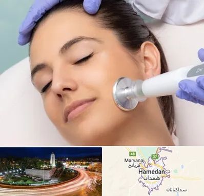 پلاسما جت در همدان