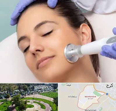 پلاسما جت در مهرشهر کرج